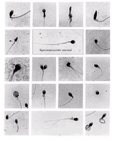 spermatozoide1